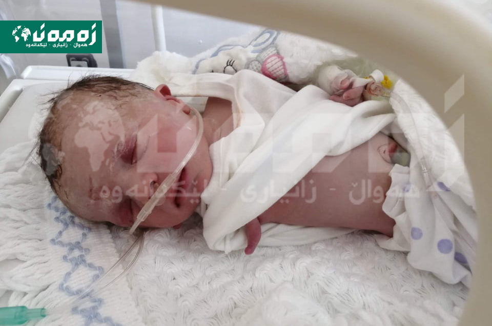منداڵێکی یەک دەست لەدایکبوو